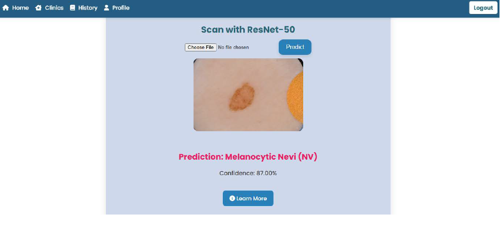Dermascan Results